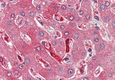 Anti-Ferritin Heavy chain antibody, C-term used in IHC (Paraffin sections) (IHC-P). GTX88497