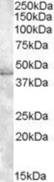 Anti-Muscleblind-like 1 antibody, C-term used in Western Blot (WB). GTX88502