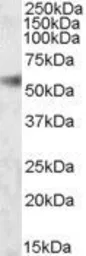Anti-SH2D4A antibody, Internal used in Western Blot (WB). GTX88504
