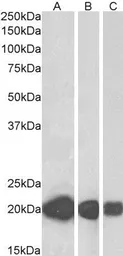 Anti-CSRP3 antibody, Internal used in Western Blot (WB). GTX88505