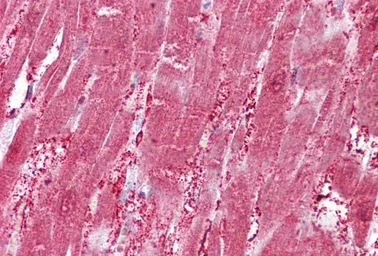 Anti-CSRP3 antibody, Internal used in IHC (Paraffin sections) (IHC-P). GTX88505