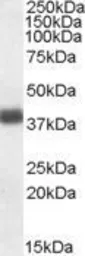 Anti-Apolipoprotein L2 antibody, C-term used in Western Blot (WB). GTX88507