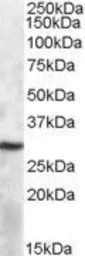 Anti-APOBEC1 antibody, Internal (near N-term) used in Western Blot (WB). GTX88509