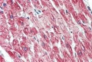 Anti-Desmin antibody, C-term used in IHC (Paraffin sections) (IHC-P). GTX88510