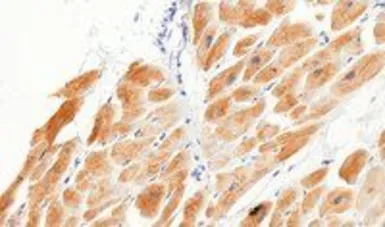Anti-Desmin antibody, C-term used in IHC (Paraffin sections) (IHC-P). GTX88510