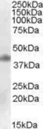 Anti-MEIS1 antibody, Internal used in Western Blot (WB). GTX88513