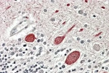 Anti-MT2 antibody, C-term used in IHC (Paraffin sections) (IHC-P). GTX88515