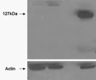 Anti-Tankyrase 2 antibody, Internal used in Western Blot (WB). GTX88516