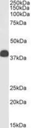 Anti-Clusterin antibody, C-term used in Western Blot (WB). GTX88520