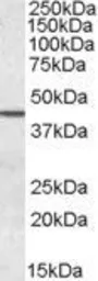 Anti-Septin 2 antibody, N-term used in Western Blot (WB). GTX88523