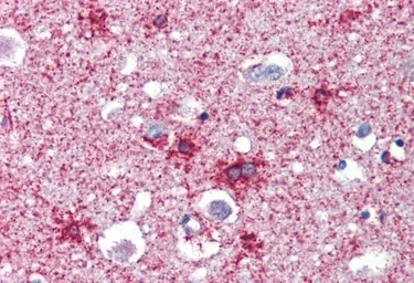 Anti-Septin 2 antibody, N-term used in IHC (Paraffin sections) (IHC-P). GTX88523