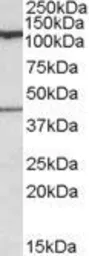 Anti-COG1 antibody, Internal used in Western Blot (WB). GTX88525