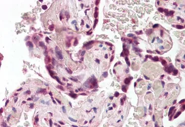 Anti-SODD antibody, Internal used in IHC (Paraffin sections) (IHC-P). GTX88531