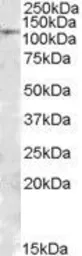 Anti-MTHFD1 antibody, Internal used in Western Blot (WB). GTX88541