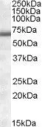 Anti-COL4A3BP (aa396-411) antibody, Internal used in Western Blot (WB). GTX88545