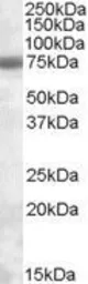 Anti-EXOSC9 antibody, C-term used in Western Blot (WB). GTX88547