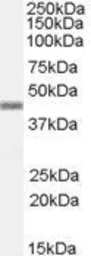 Anti-APOBEC3G antibody, C-term used in Western Blot (WB). GTX88548