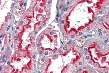 Anti-APOBEC3G antibody, C-term used in IHC (Paraffin sections) (IHC-P). GTX88548