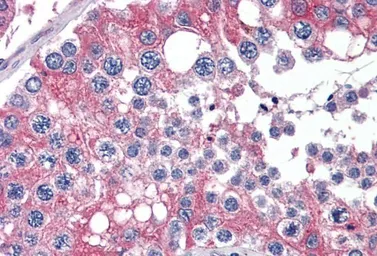 Anti-APOBEC3G antibody, C-term used in IHC (Paraffin sections) (IHC-P). GTX88548