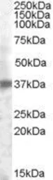 Anti-TACSTD2 antibody, Internal used in Western Blot (WB). GTX88555