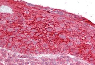 Anti-TACSTD2 antibody, Internal used in IHC (Paraffin sections) (IHC-P). GTX88555