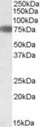 Anti-EBF1 antibody, Internal used in Western Blot (WB). GTX88556