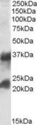 Anti-CTLA + CTLB antibody, Internal used in Western Blot (WB). GTX88557