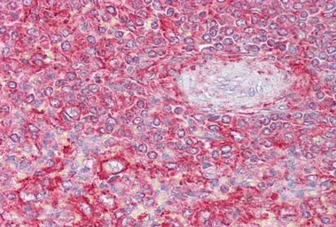 Anti-CTLA + CTLB antibody, Internal used in IHC (Paraffin sections) (IHC-P). GTX88557