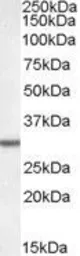 Anti-Dpm1 antibody, N-term used in Western Blot (WB). GTX88561