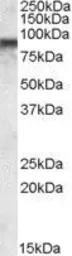 Anti-COG7 antibody, Internal used in Western Blot (WB). GTX88563