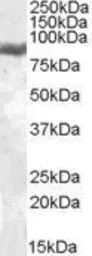 Anti-Lactoferrin antibody, Internal used in Western Blot (WB). GTX88565