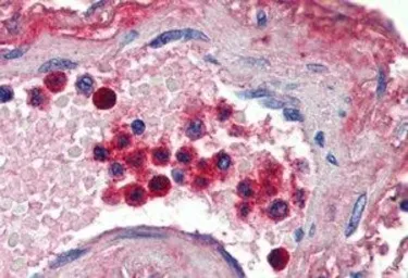 Anti-Lactoferrin antibody, Internal used in IHC (Paraffin sections) (IHC-P). GTX88565