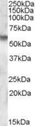 Anti-IDS antibody, Internal used in Western Blot (WB). GTX88566