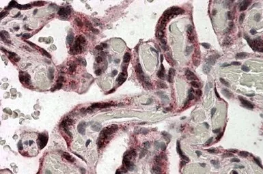 Anti-IDS antibody, Internal used in IHC (Paraffin sections) (IHC-P). GTX88566