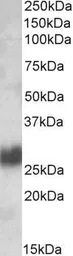 Anti-CD90 antibody, Internal used in Western Blot (WB). GTX88569