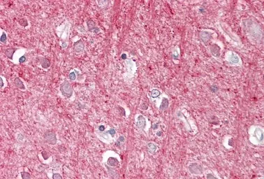 Anti-CD90 antibody, Internal used in IHC (Paraffin sections) (IHC-P). GTX88569