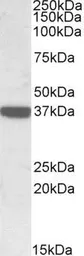 Anti-Calponin 3 antibody, C-term used in Western Blot (WB). GTX88571