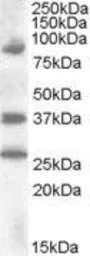 Anti-HOXD10 antibody, Internal used in Western Blot (WB). GTX88572
