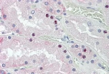 Anti-HOXD10 antibody, Internal used in IHC (Paraffin sections) (IHC-P). GTX88572