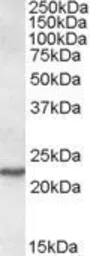 Anti-SAR1A antibody, Internal used in Western Blot (WB). GTX88575