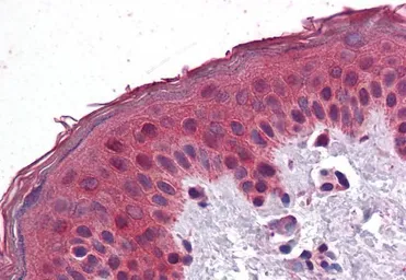 Anti-SAR1A antibody, Internal used in IHC (Paraffin sections) (IHC-P). GTX88575