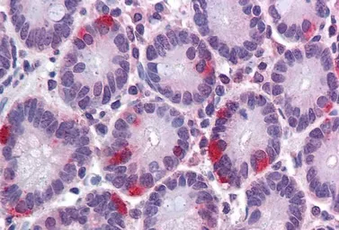 Anti-SAR1A antibody, Internal used in IHC (Paraffin sections) (IHC-P). GTX88575