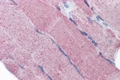 Anti-PACE4 antibody, Internal used in IHC (Paraffin sections) (IHC-P). GTX88576