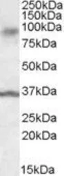 Anti-ANKK1 antibody, Internal used in Western Blot (WB). GTX88578