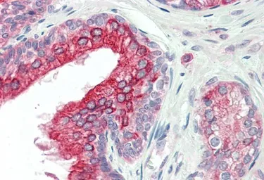 Anti-ANKK1 antibody, Internal used in IHC (Paraffin sections) (IHC-P). GTX88578