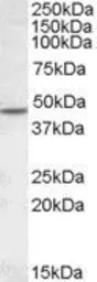 Anti-AChR beta 2 antibody, Internal used in Western Blot (WB). GTX88583
