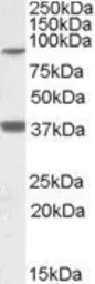 Anti-LASS1 antibody, Internal used in Western Blot (WB). GTX88587