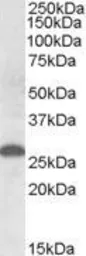 Anti-Apolipoprotein M antibody, Internal used in Western Blot (WB). GTX88588