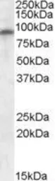 Anti-GluR4 antibody, Internal used in Western Blot (WB). GTX88589