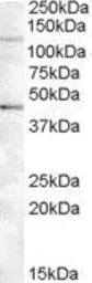 Anti-Tankyrase 2 antibody, Internal used in Western Blot (WB). GTX88590